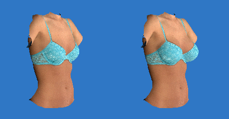 Vectra 3D imaging breast animation